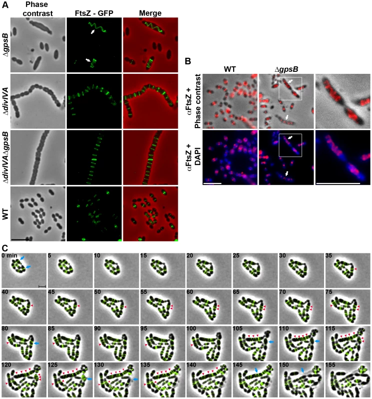 FtsZ localization in WT, Δ<i>divIVA</i>, Δ<i>gpsB</i> and Δ<i>divIVA</i>Δ<i>gpsB</i> cells.