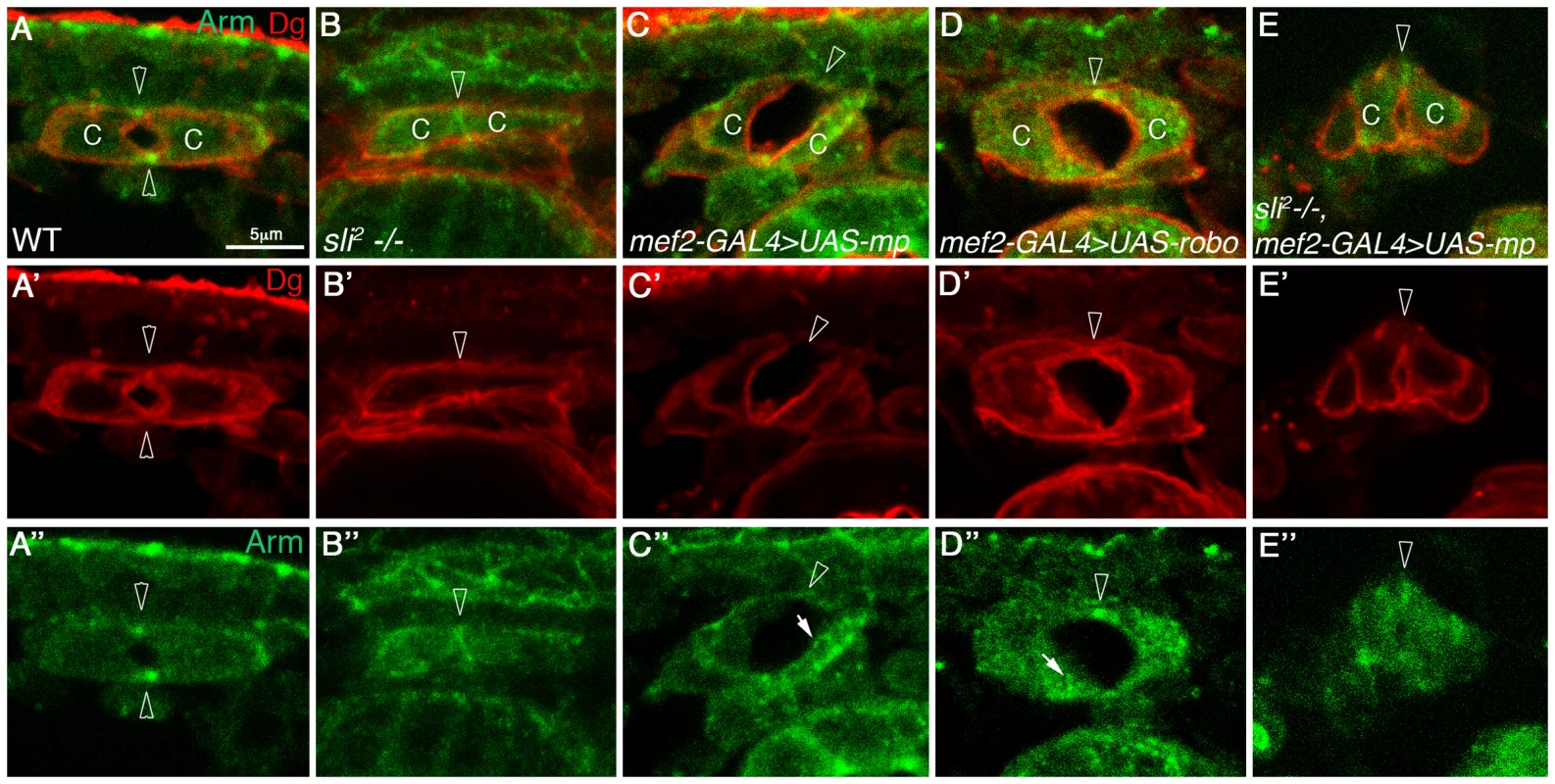 Mp activity in cardioblasts depends on Slit.