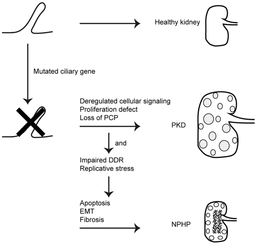 Schematic overview of signaling cascade involved in development of PKD and NPHP.