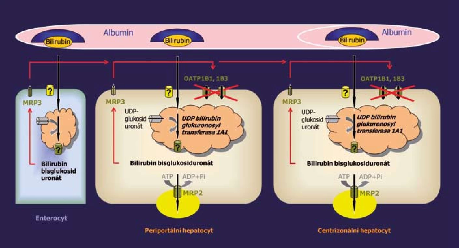 Porucha jaterního vychytávání konjugovaného bilirubinu vyvolaná deficitem OATP1B1 a OATP1B3 je příčinou Rotorova syndromu.
Fig. 1. Impaired liver uptake of conjugated bilirubin caused by OATP1B1 and OATP1B3 deficiency is the molecular basis of Rotor syndrome.