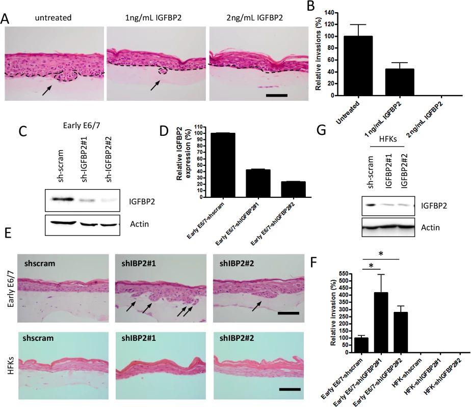 IGFBP2 is a regulator of the invasion process.