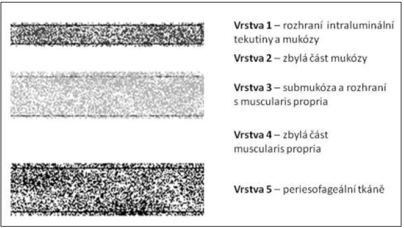 Vrstvy stěny jícnu v echoendoskopickém obraze – schéma
Fig. 2: Oesophageal wall layers in an endoscopic ultrasound picture – diagram