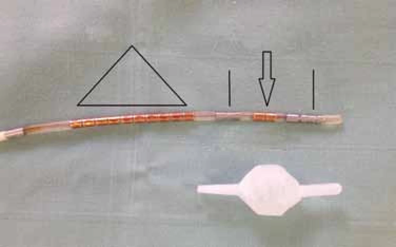 HRAM katetr s rektálním balonkem.
Fig. 3. HRAM catheter with rectal balloon.