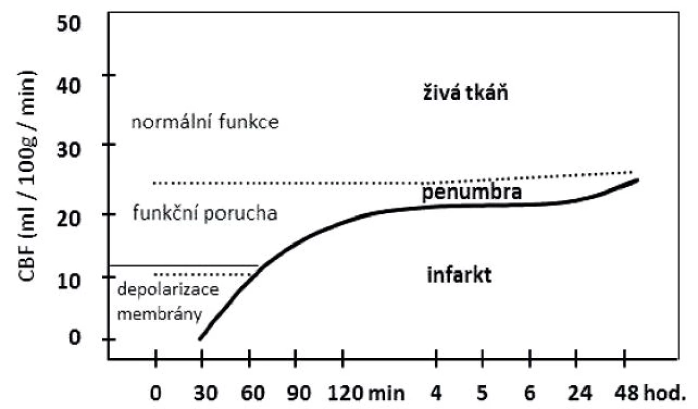 Vývoj mozkového infarktu v závislosti na poklesu mozkové perfuze. (Modifikováno z Ambler, Bauer, 2010.)