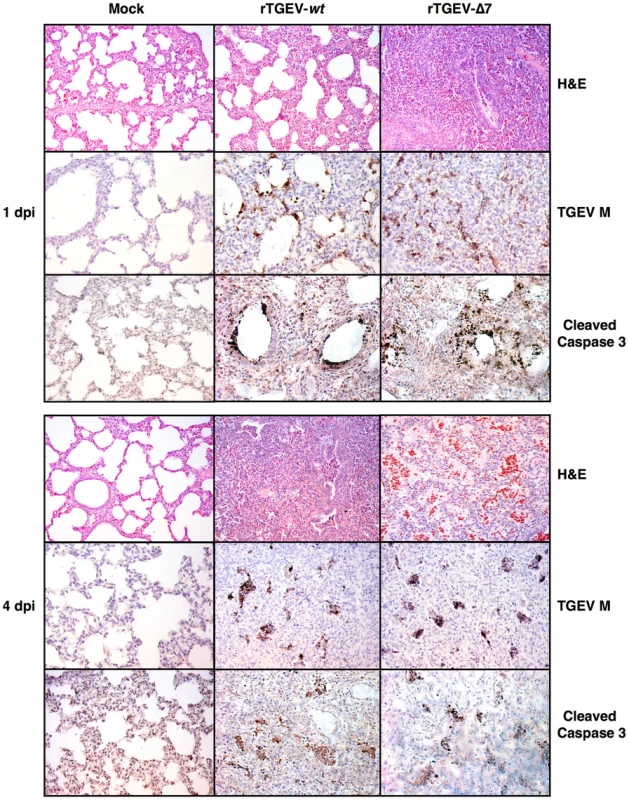 Lung histopathology caused by rTGEV-Δ7 infection.