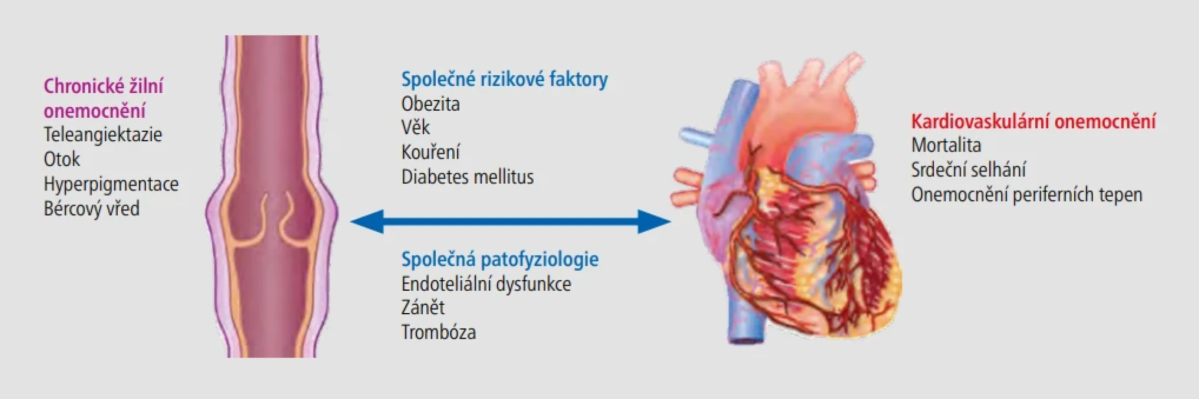  – Průsečíky chronického žilního onemocnění a kardiovaskulárních onemocnění. [Upraveno podle: Hamburg NH. The legs are a pathway to the heart: connections between chronic venous insufficency and cardiovascular disease. Eur Heart J 2021;42(40):4166–4168.]