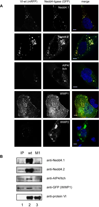 Protein VI interacts with Nedd4 ligases via the PPxY motif.