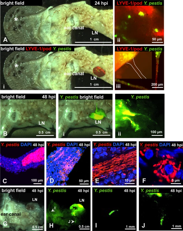 <i>Y. pestis</i> in afferent lymphatic vessels and LNs.