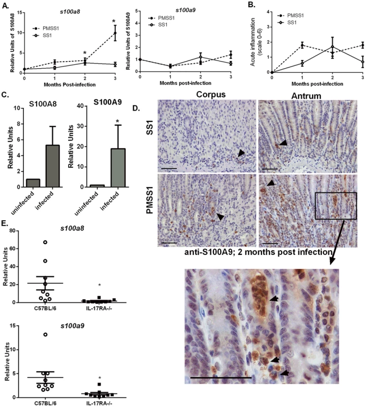 Host CP (S100A8/A9) is elevated in <i>H. pylori</i> infected stomach tissue.