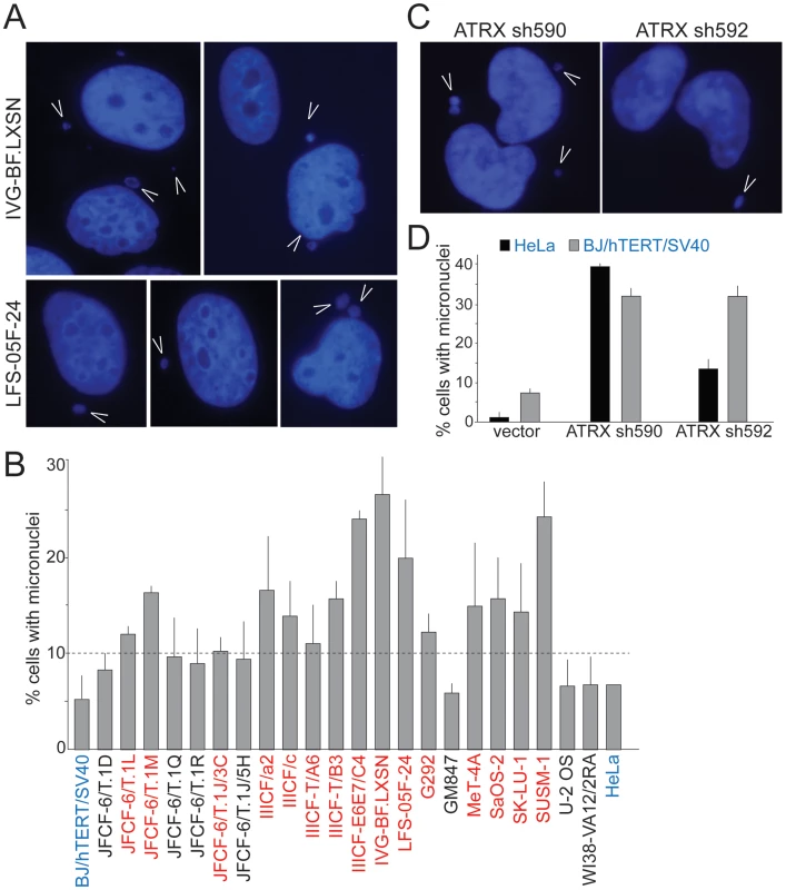 Frequent micronucleation in ALT cells may be attributable to loss of ATRX.