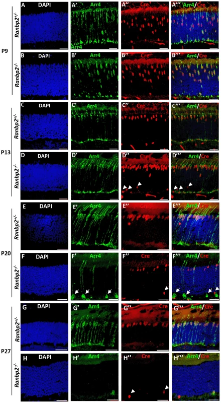 Temporal and morphological profile of degeneration of cone photoreceptors in <i>Ranbp2<sup>−/−</sup></i> mice.
