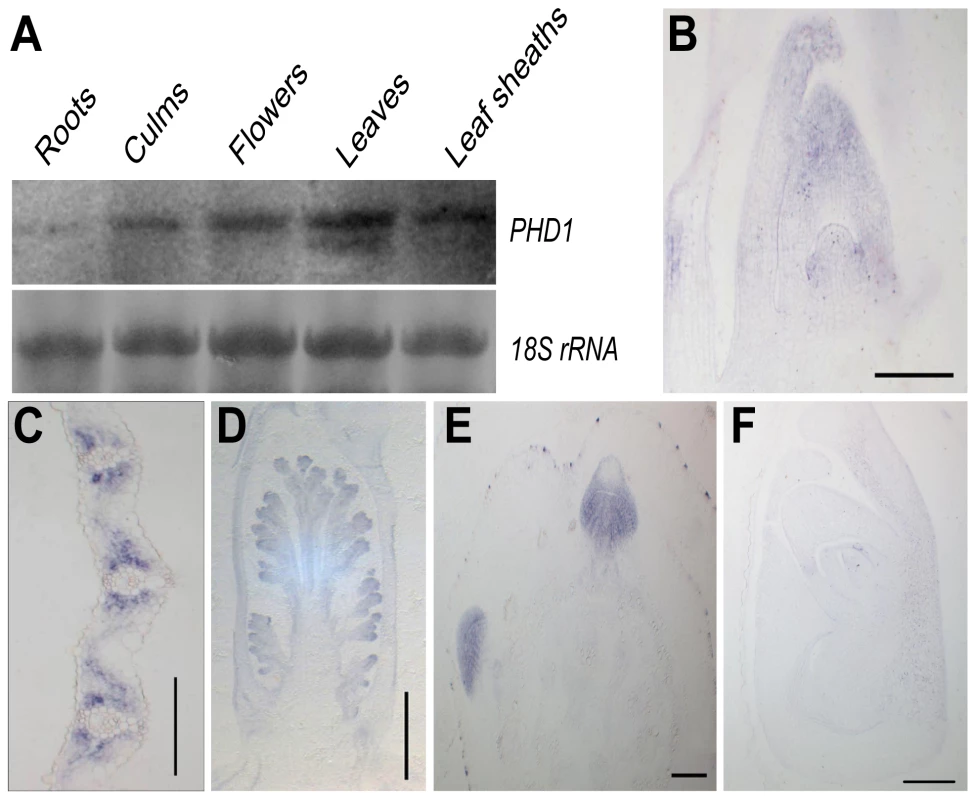 Expression analysis of <i>PHD1</i>.