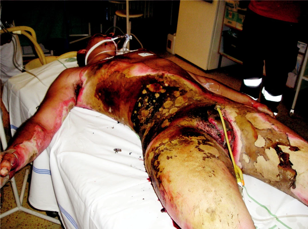 General view of the patient on admission