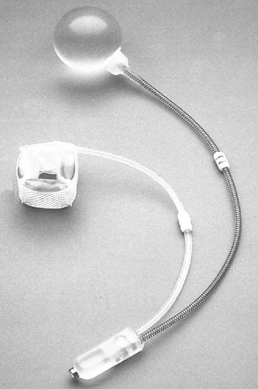 Umělý svěrač anu
Pic. 1. Artificial of the anus sphincter