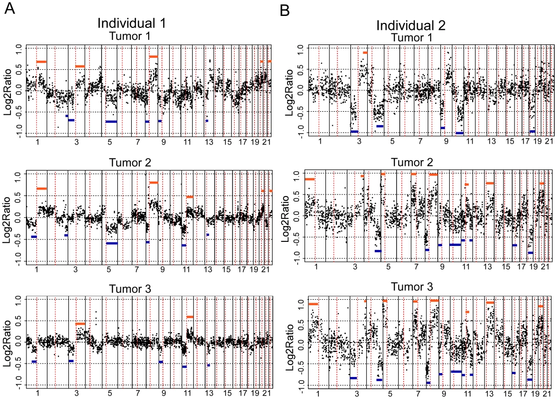 aCGH profiles of independent tumors from two individuals.