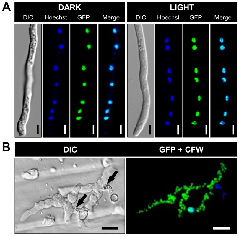BcLTF1-GFP fusion proteins are localized in the nuclei.