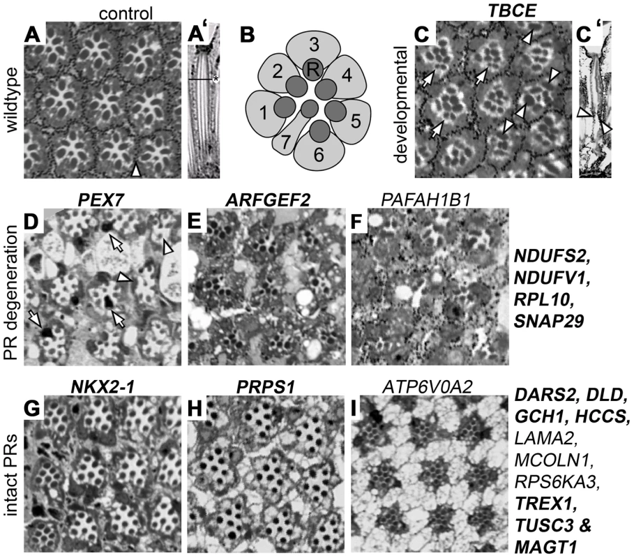 Histological analysis of <i>Drosophila</i> ID gene knockdown eyes with ERG defects.