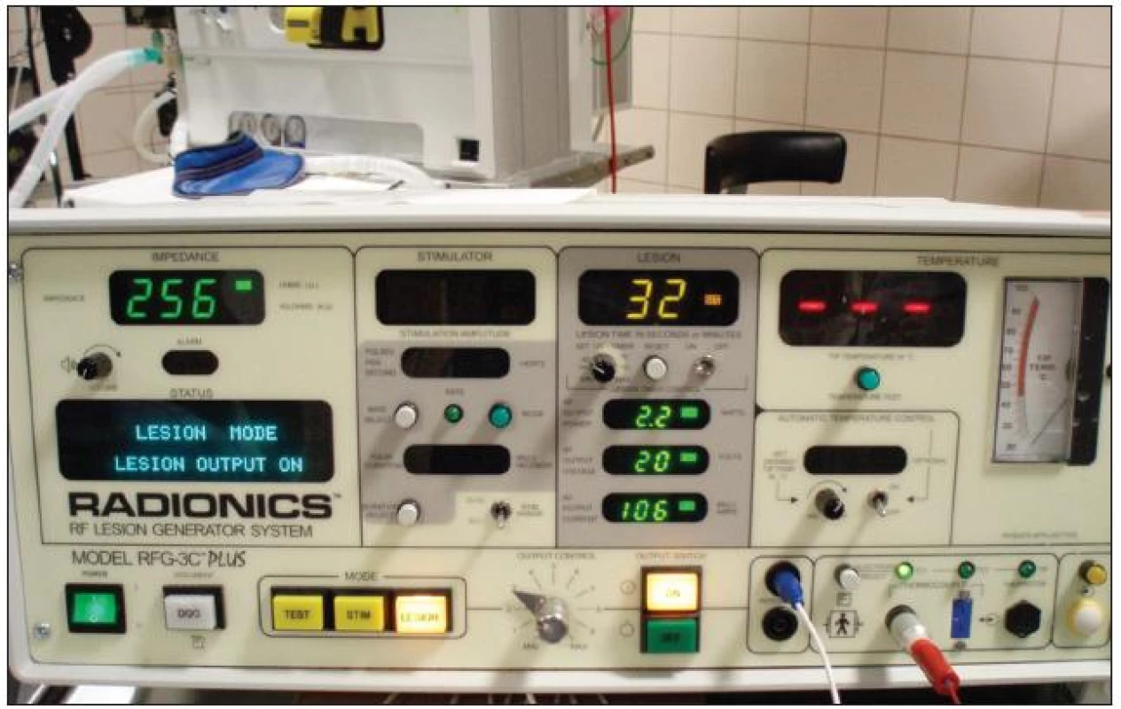 Radiofrekvenční generátor Radionics RFG-3C Plus, Radionics Inc., USA.