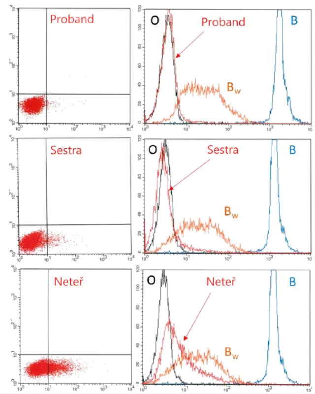 Dot plot a histogram
