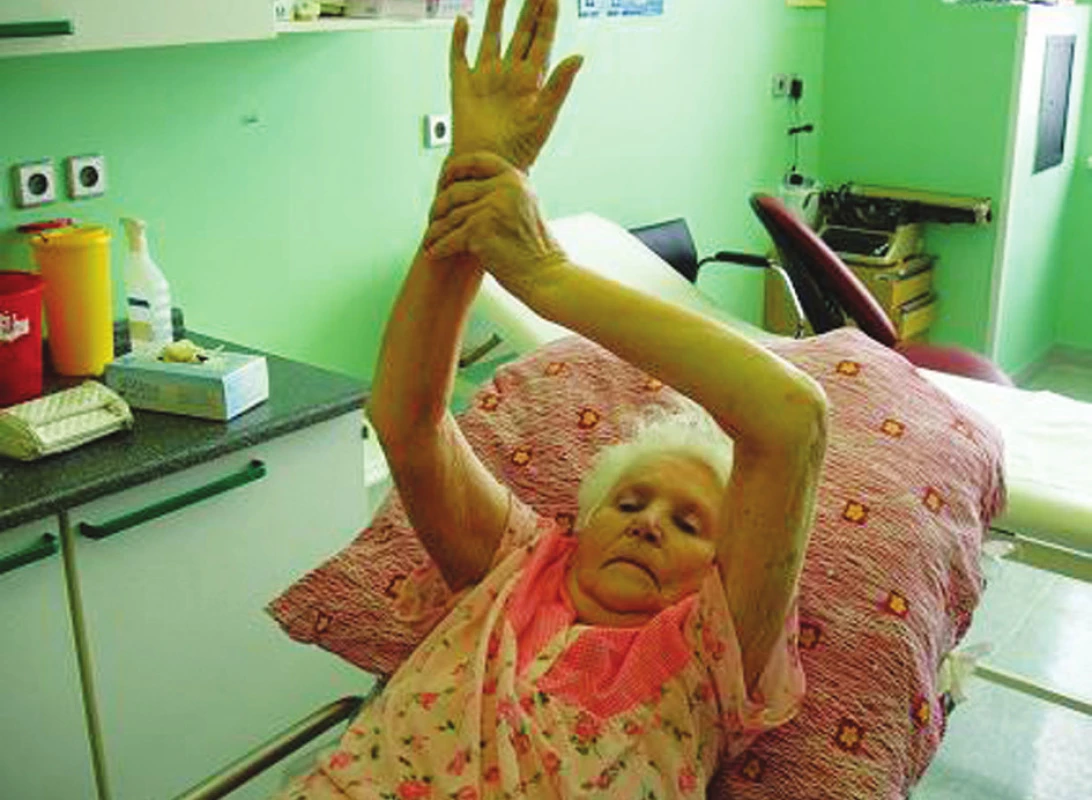 Pacientka 7 týdnů od operace
Fig. 4. The patient, postoperative week 7