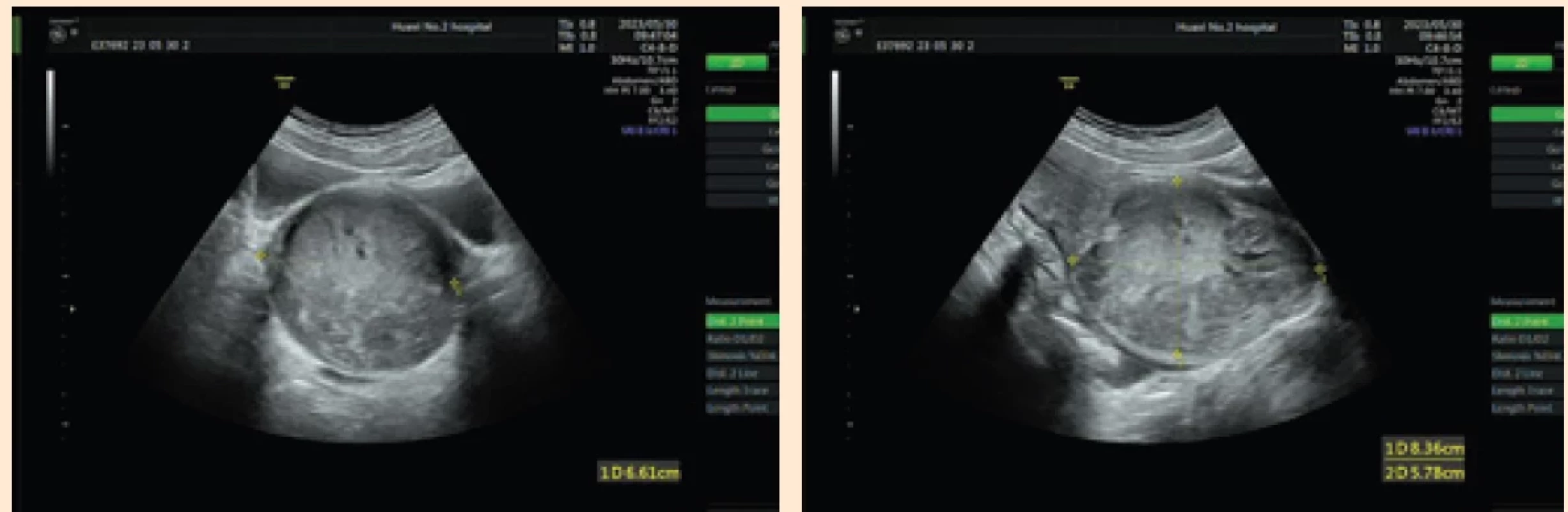 Ultrasound indications. Obr. 1. Ultrazvukové indikace.