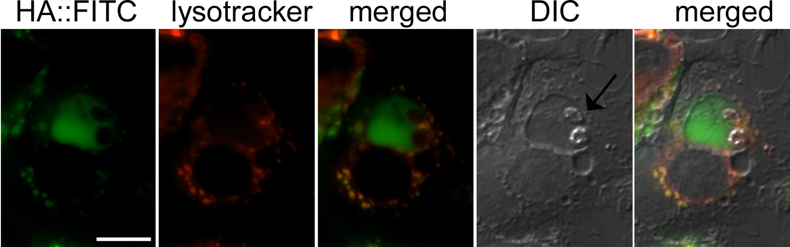 Hyaluronan localization to the <i>Leishmania</i> containing phagolysosome.