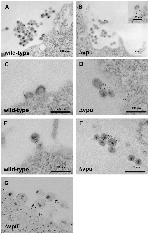 Electron microscopic evidence of direct virion tethering and virion-incorporation of BST-2.