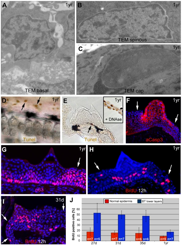 Basal tubercle cells display increased proliferation rates, upper cells increased levels of activated caspase 3 in the absence of other hallmarks of cell death.