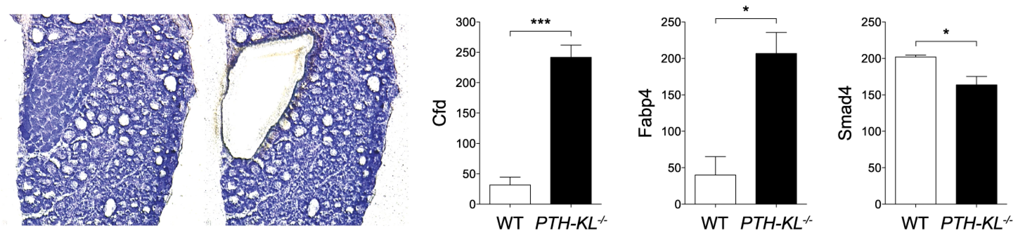 Parathyroid transcriptional data.