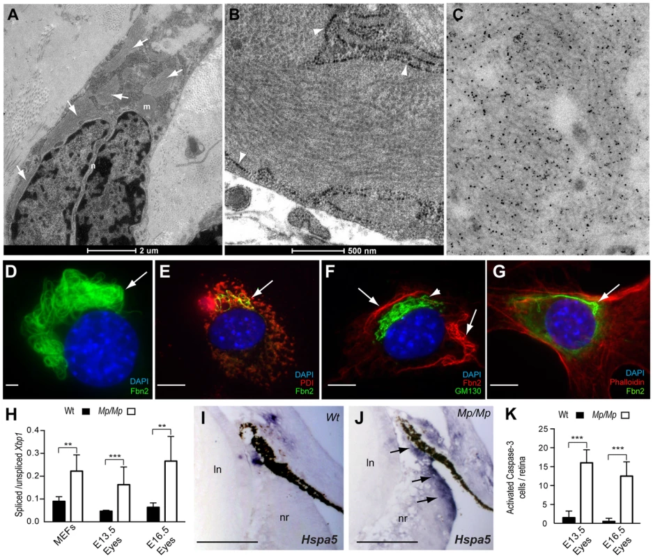 Fibrillin-2<sup>Mp</sup> inclusions resulted in ER-stress and cell death in the developing <i>Mp</i> eye.