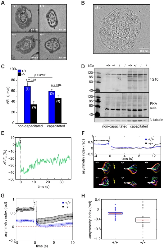 CRIS controls the development of flagellar bending.