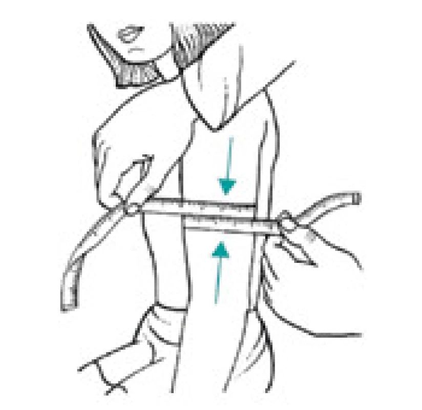Měření středního obvodu paže (v polovině vzdálenosti acromion – epicondylus radialis)