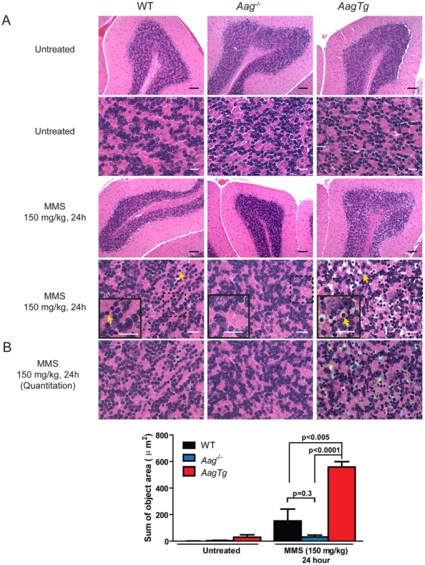 MMS induces severe cerebellar lesions <i>AagTg</i> mice.