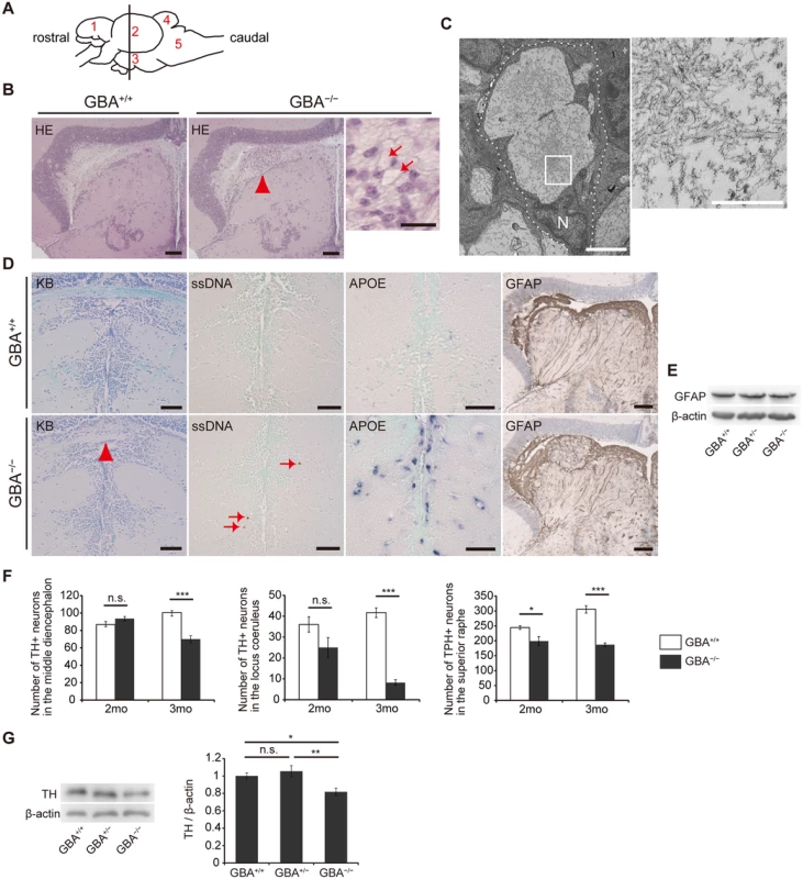 Pathological analyses of <i>GBA</i><sup>-/-</sup> medaka.