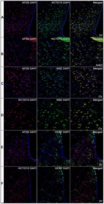Co-localization of AP2β and KCTD15 immunoreactivity in hypothalamus and striatum.