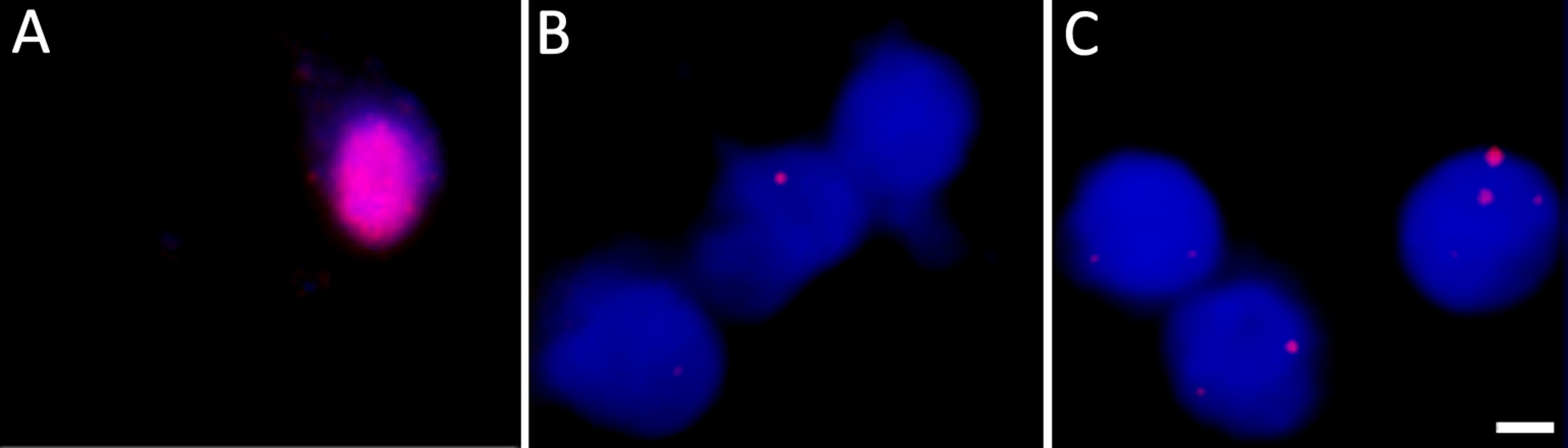 DNA fluorescent <i>in situ</i> hybridization confirms the presence of VZV genomes in nuclei of hESC-derived neurons quiescently infected with VZV.