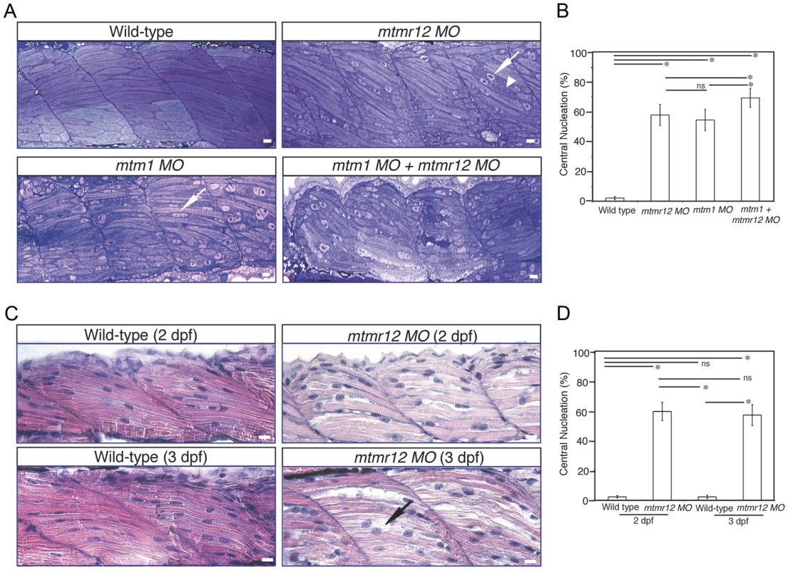 Abnormal histology of MTMR12-deficient zebrafish.