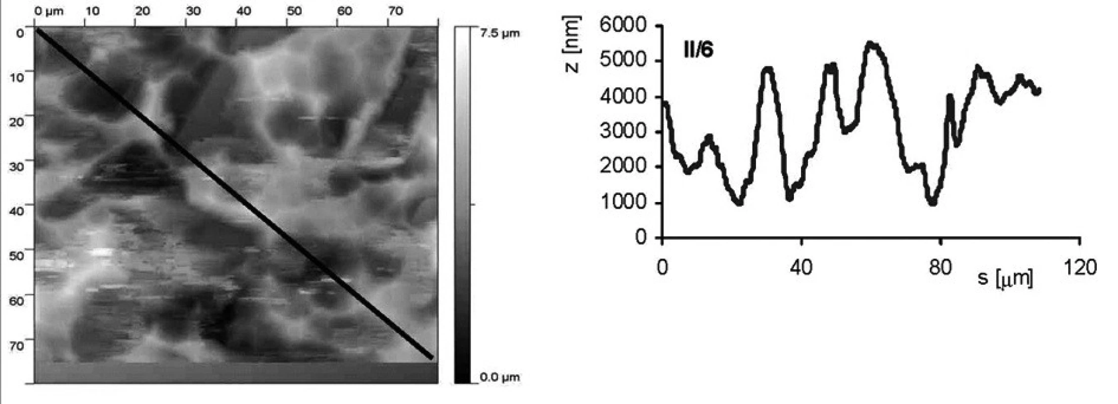 AFM vzorku II/6 (pískovaný zrnitostí 120 a leptaný s povrchovou ztrátou materiálu 0,03 mm). Snímek povrchu a jeho profil ve směru úhlopříčky, naznačené ve snímku, byl měřen pomocí AFMmikroskopu Explorer III (Veeco, Santa Barbara, Kalifornie,USA).