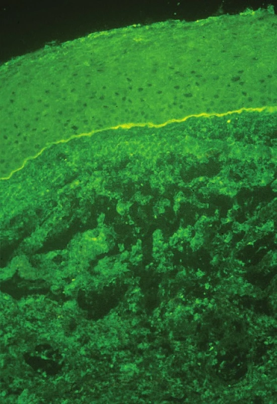 Přímá imunofluorescence