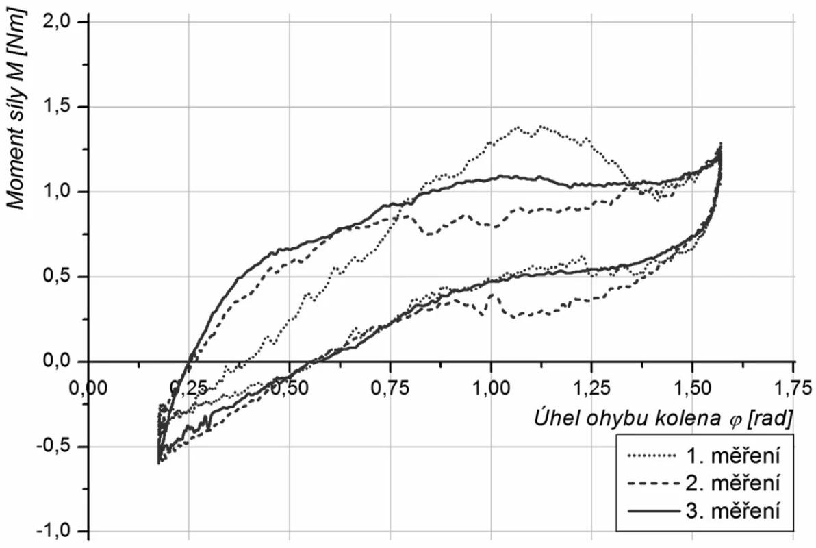 Změny bioreogramů v průběhu léčby ruptury předního zkříženého vazu