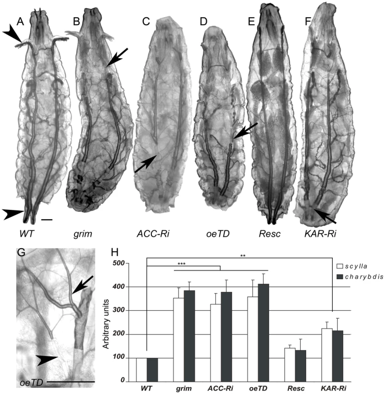 Oenocytes ACC signals to the tracheal system.