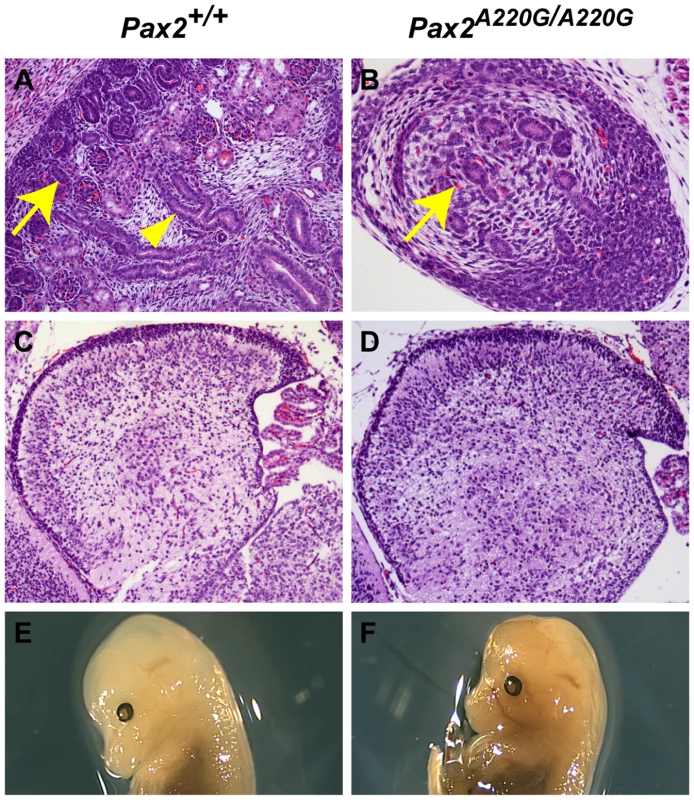 Histologic sections of <i>Pax2<sup>+/+</sup></i> and <i>Pax2<sup>A220G/A220G</sup></i> mouse kidneys (axial) and cerebellum (sagittal) at E17.5.