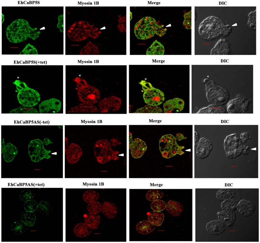 Erythrophagocytosis of cells overexpressing EhCaBP5 antisense and sense RNA constructs in the presence and the absence of tetracycline.