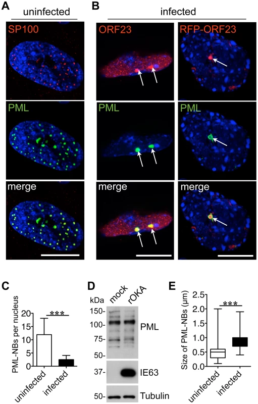 Endogenous PML-NBs colocalize with ORF23 capsid protein in VZV infected cells.