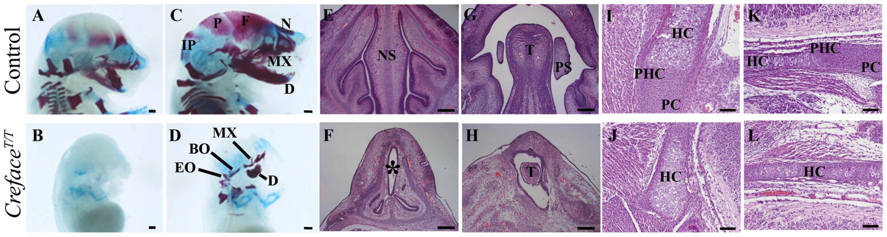 <i>Creface<sup>T/T</sup></i> embryos exhibit major cranioskeletal malformations.