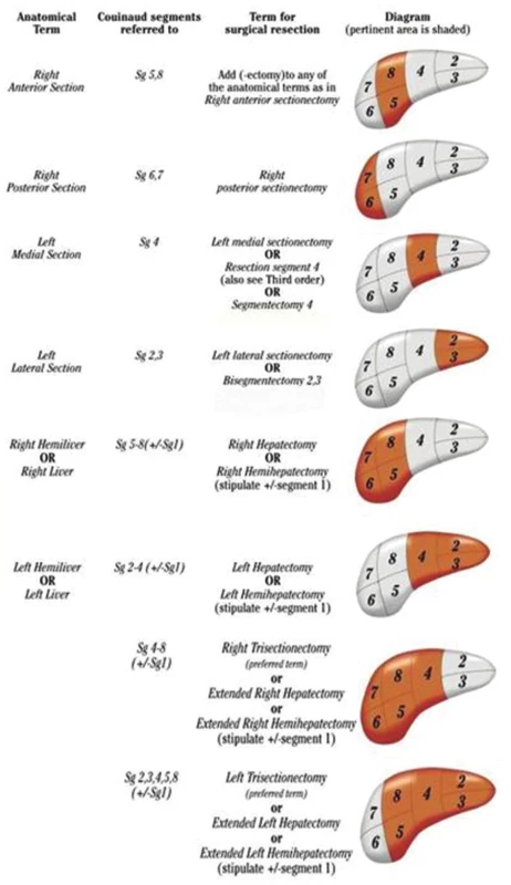 Terminologie jaterních resekcí [49]
Fig. 1: Terminology of liver resections [49]
