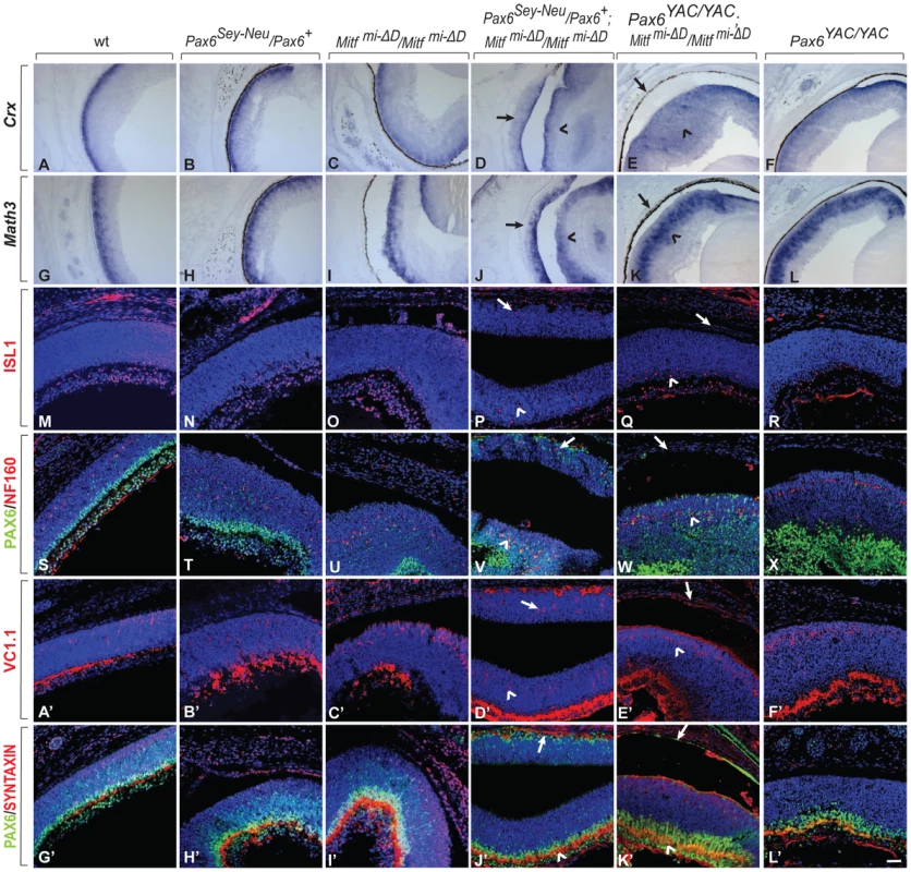 Development of a differentiated laminated retina in <i>Pax6<sup>Sey-Neu</sup>/Pax6<sup>+</sup>;Mitf<sup>mi-<i>Δ</i>D</sup>/Mitf<sup> mi-<i>Δ</i>D</sup></i> but not <i>Pax6<sup>YAC/YAC</sup>;Mitf <sup>mi-<i>Δ</i>D</sup>/Mitf <sup>mi-<i>Δ</i>D</sup></i> mice.