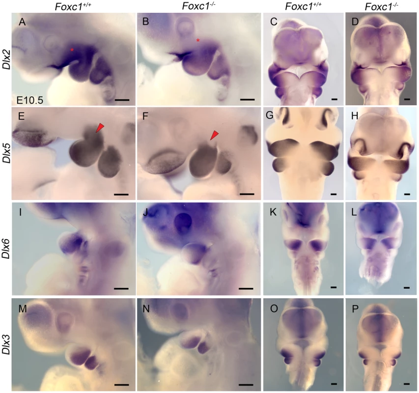 Disruption of proximal <i>Dlx</i> code in PA1 of <i>Foxc1<sup>−/−</sup></i> embryos.