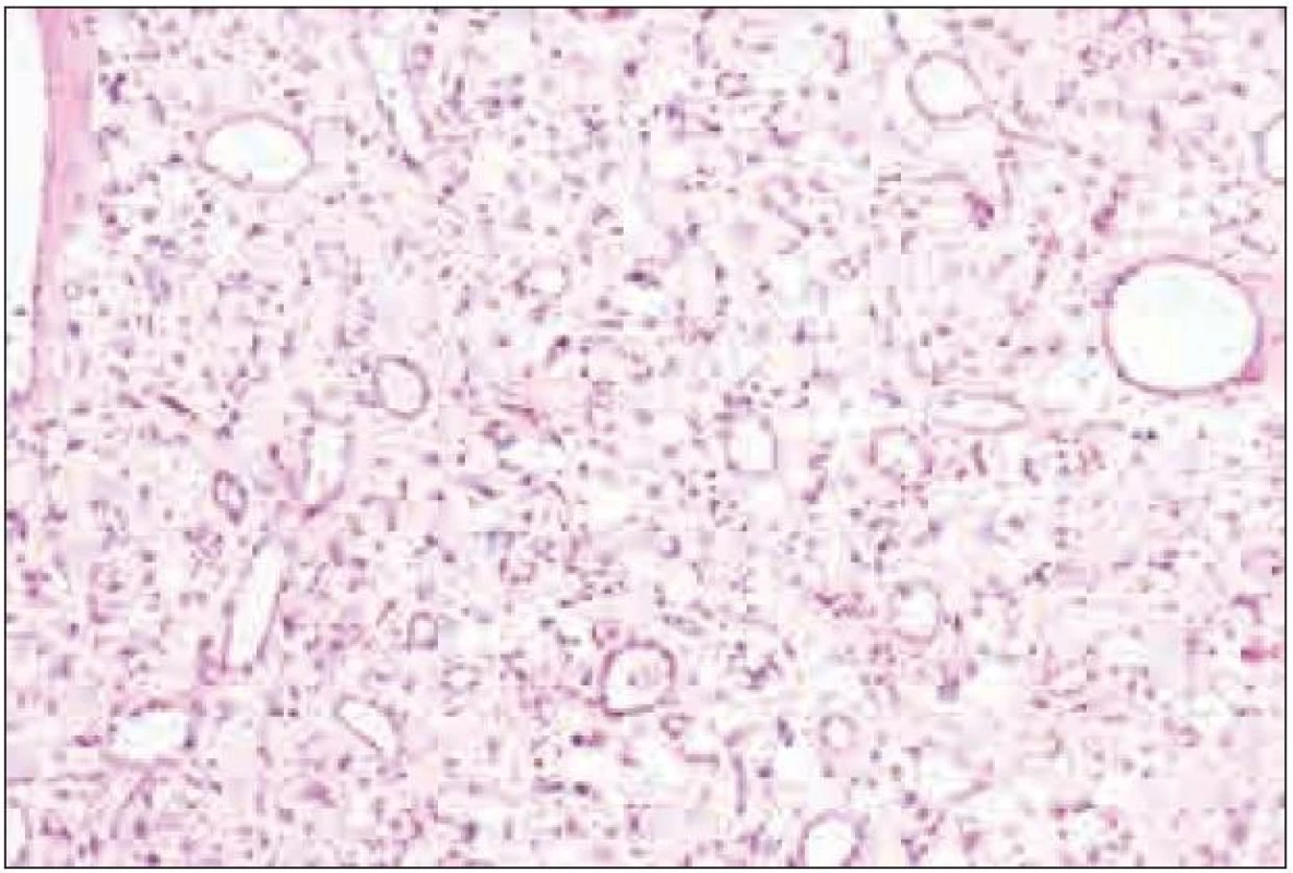 Histologie – hematoxylin-eosin, 100krát.