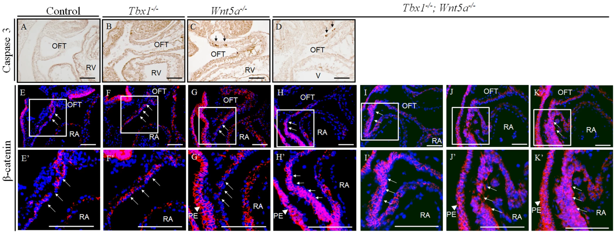 β-Catenin is upregulated in the SHF of <i>Tbx1<sup>−/−</sup>;Wnt5a<sup>−/−</sup></i> embryos at E9.5.